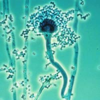 Dust Mites